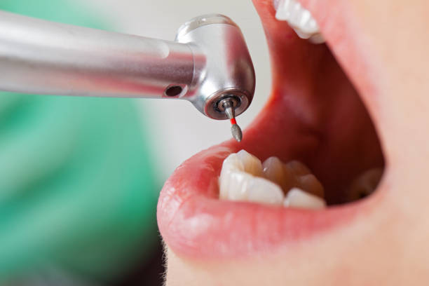 Best Urgent Dental Care for Toothache in Grottoes, VA